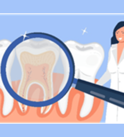 Root canal treatment