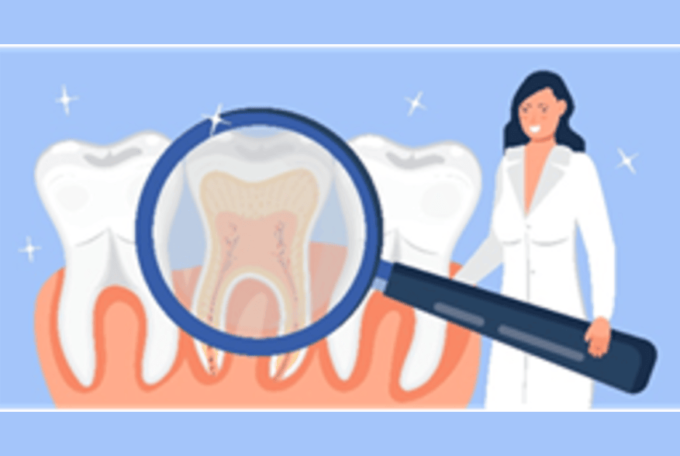 Why might I need root canal treatment?