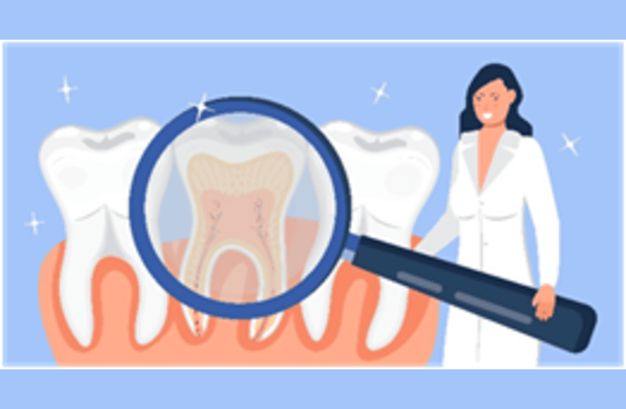 Root canal treatment