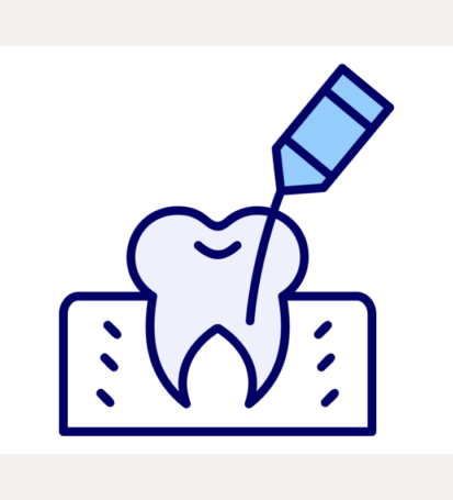 Root canal treatment