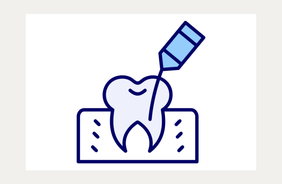 Root canal treatment