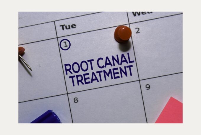 Your Root Canal Journey: What to Expect at KentEndo